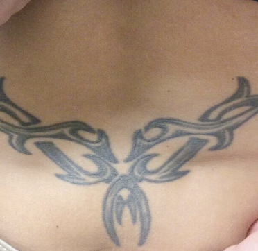 Before laser tattoo removal — Lower Back