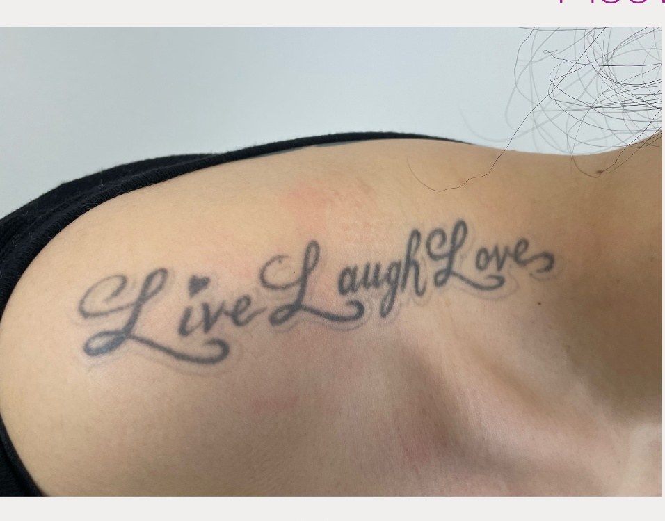 Before laser tattoo removal — Collarbone · Script